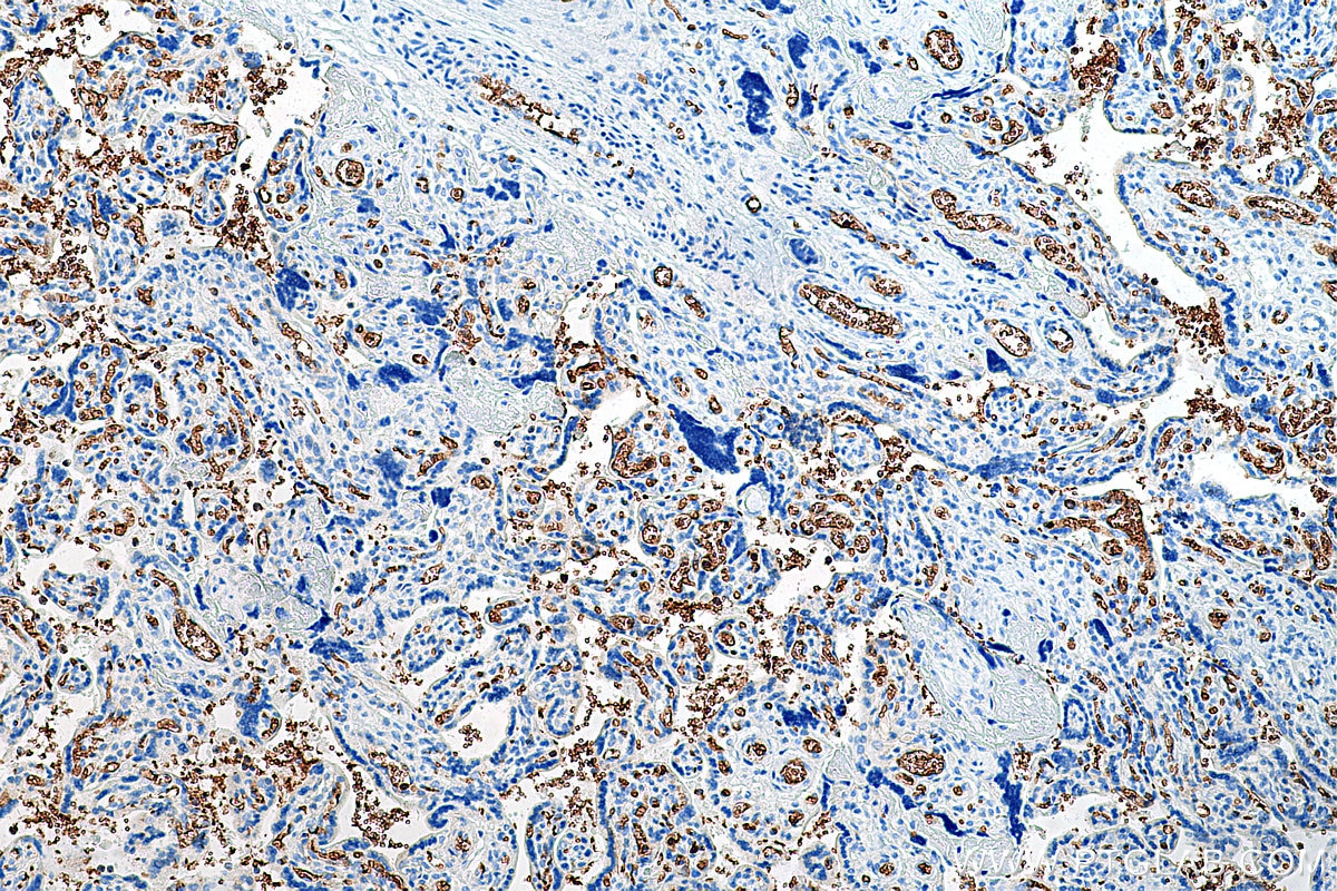 Immunohistochemistry (IHC) staining of human placenta tissue using Glycophorin A  Monoclonal antibody (66778-1-Ig)