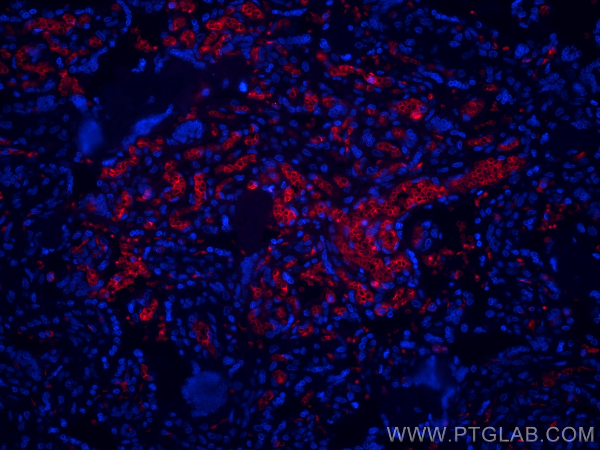 Immunofluorescence (IF) / fluorescent staining of human placenta tissue using CoraLite®594-conjugated Glycophorin A  Monoclonal  (CL594-66778)