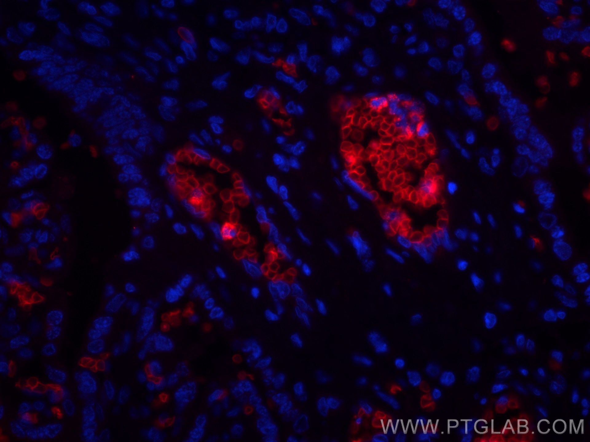 Immunofluorescence (IF) / fluorescent staining of human placenta tissue using CoraLite®594-conjugated Glycophorin A  Monoclonal  (CL594-66778)