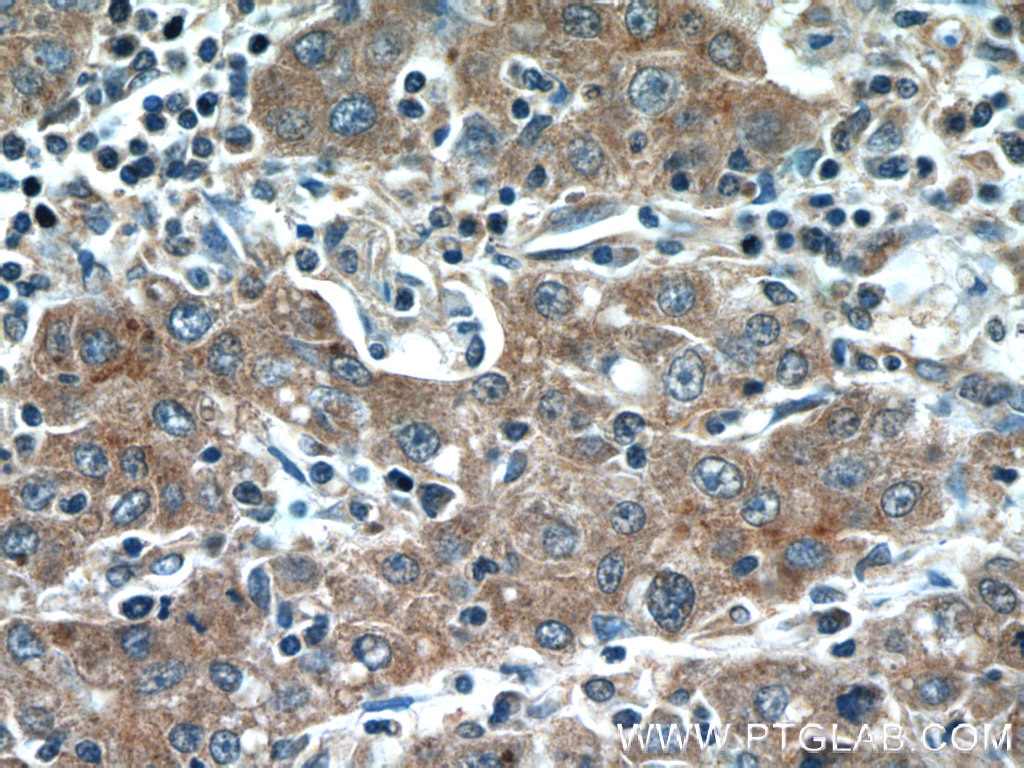 Glypican 3 Polyclonal antibody