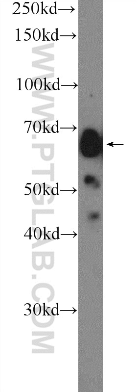 Western Blot (WB) analysis of HepG2 cells using Glypican 3 Polyclonal antibody (25175-1-AP)