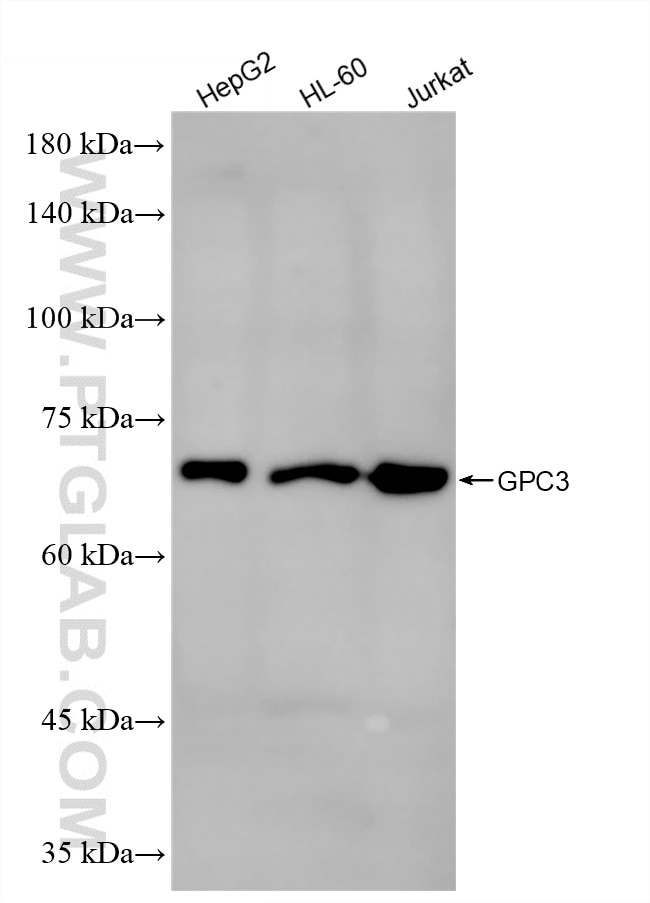 Western Blot (WB) analysis of various lysates using Glypican 3 Recombinant monoclonal antibody (86694-1-RR)