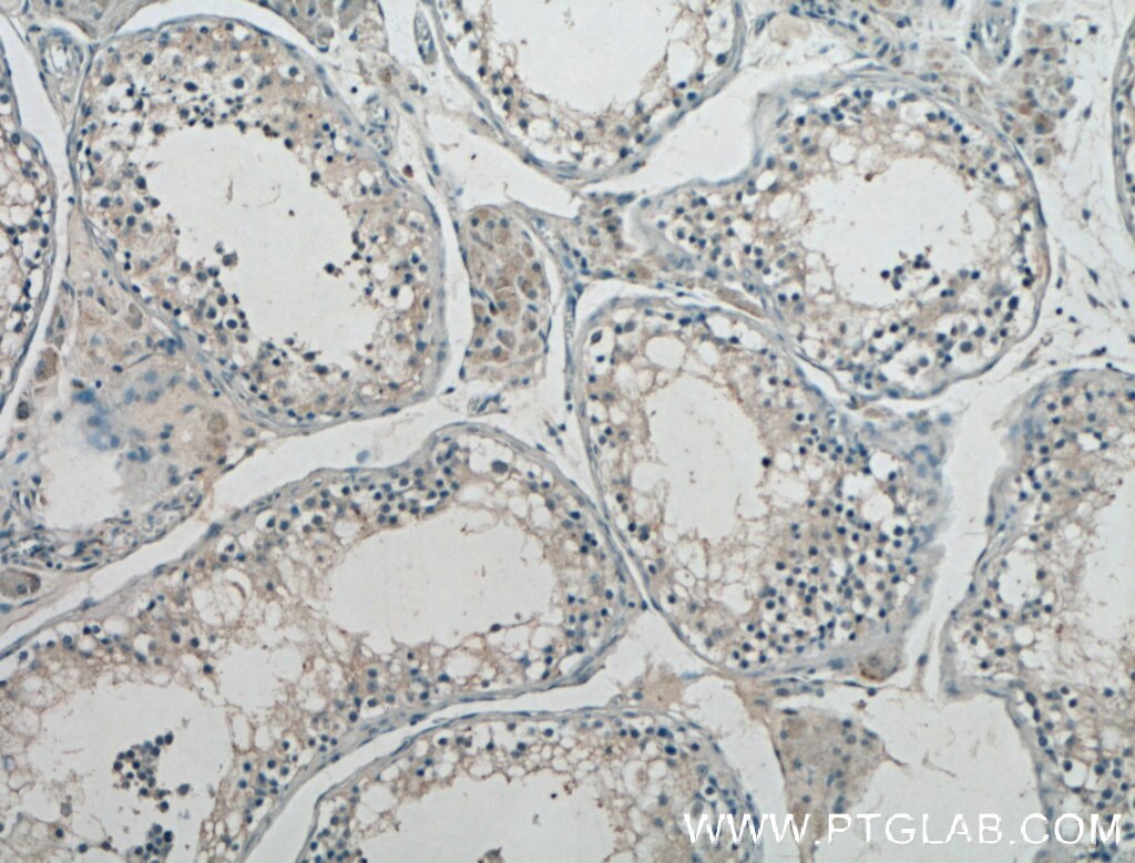 Immunohistochemistry (IHC) staining of human testis tissue using GNRH1 Polyclonal antibody (26950-1-AP)