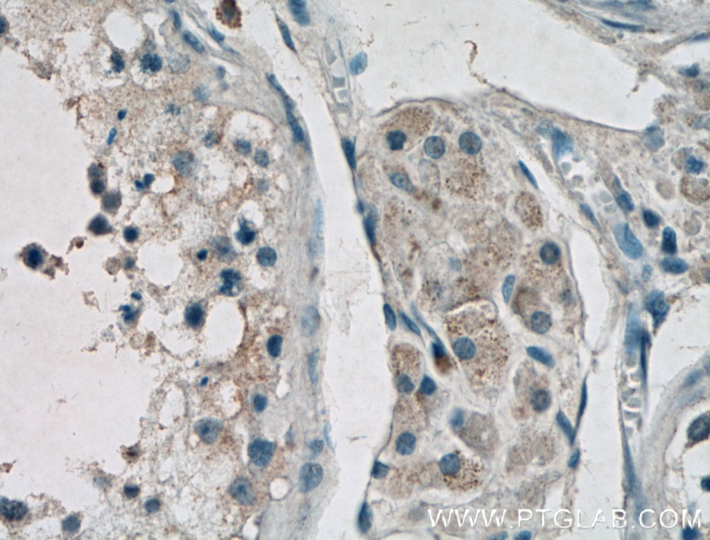 Immunohistochemistry (IHC) staining of human testis tissue using GNRH1 Polyclonal antibody (26950-1-AP)