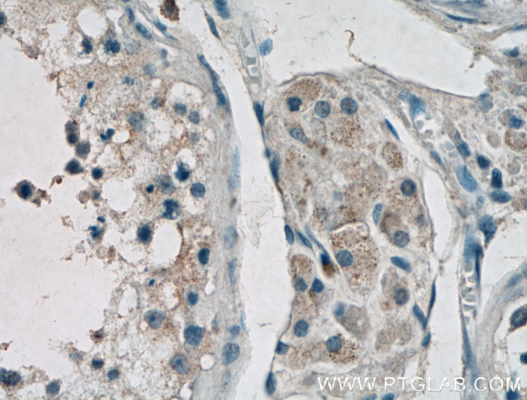 IHC staining of human testis using 26950-1-AP