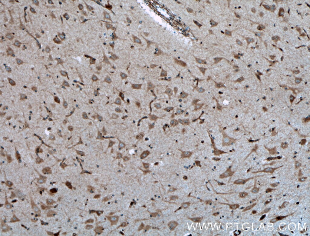 Immunohistochemistry (IHC) staining of human brain tissue using GNRH1 Polyclonal antibody (26950-1-AP)
