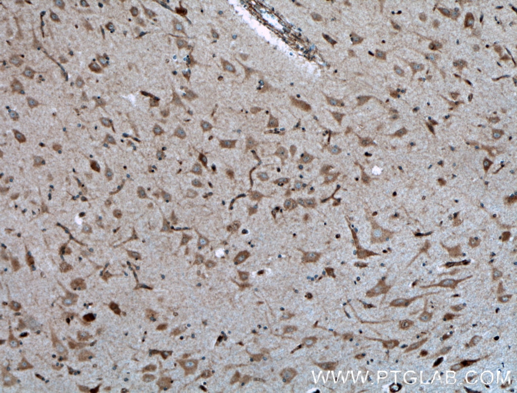 Immunohistochemistry (IHC) staining of human brain tissue using GNRH1 Polyclonal antibody (26950-1-AP)