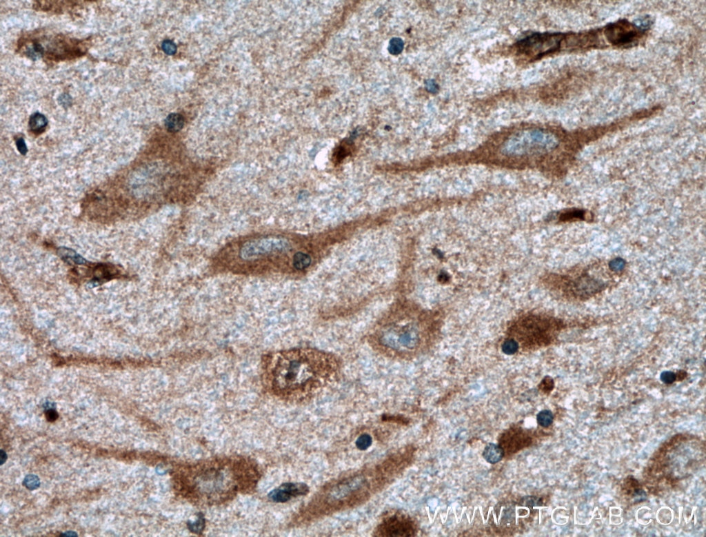 Immunohistochemistry (IHC) staining of human brain tissue using GNRH1 Polyclonal antibody (26950-1-AP)