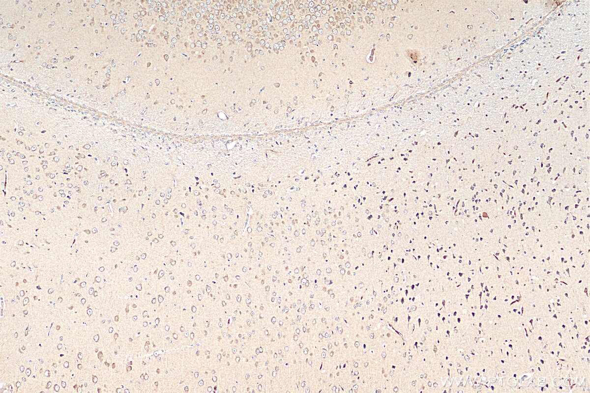 Immunohistochemistry (IHC) staining of mouse brain tissue using GNRH1 Polyclonal antibody (26950-1-AP)