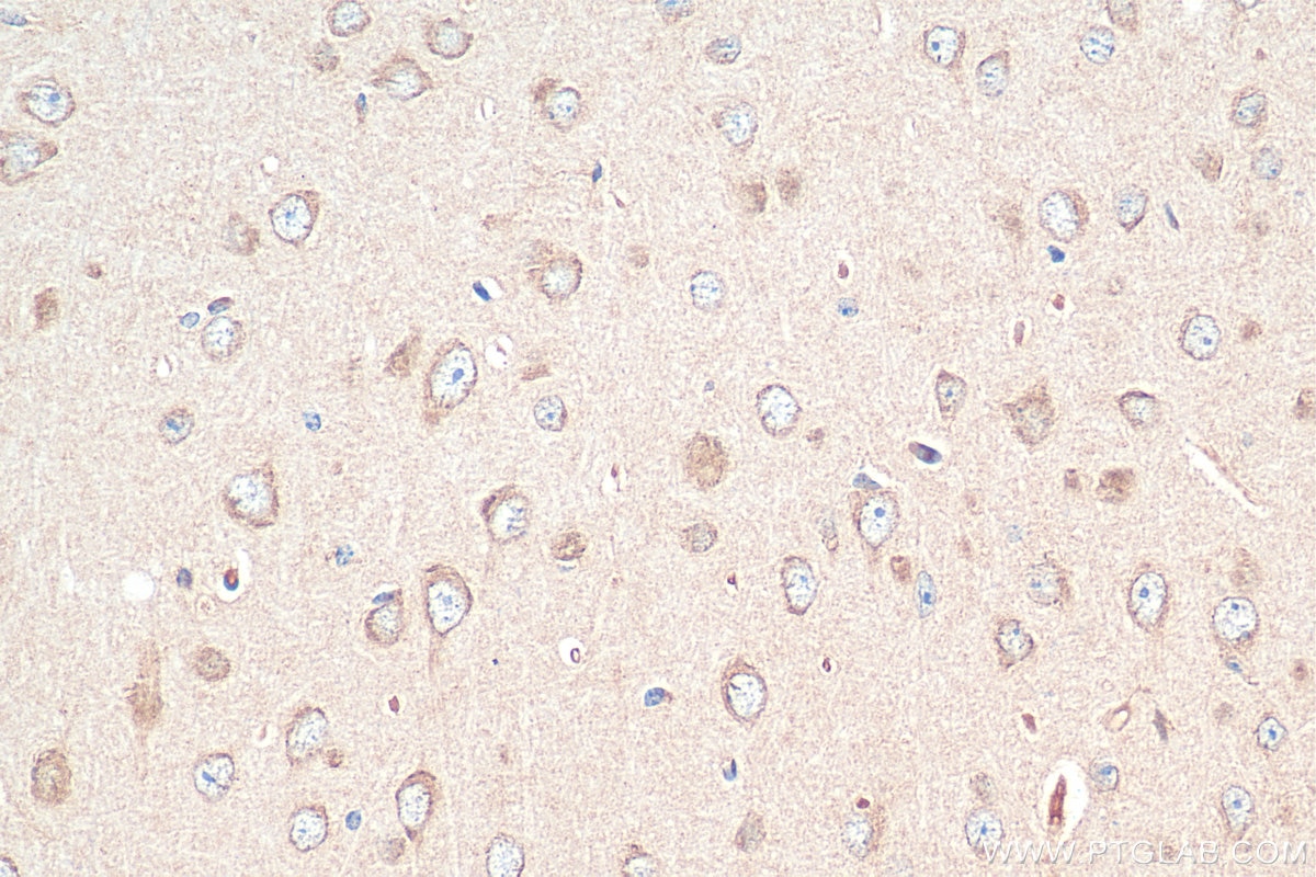 Immunohistochemistry (IHC) staining of mouse brain tissue using GNRH1 Polyclonal antibody (26950-1-AP)
