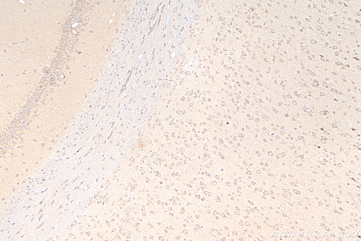 Immunohistochemistry (IHC) staining of rat brain tissue using GNRH1 Polyclonal antibody (26950-1-AP)