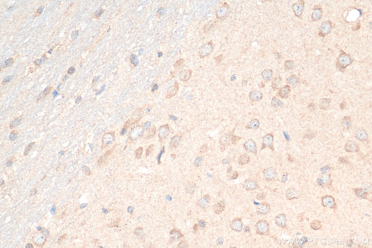Immunohistochemistry (IHC) staining of rat brain tissue using GNRH1 Polyclonal antibody (26950-1-AP)