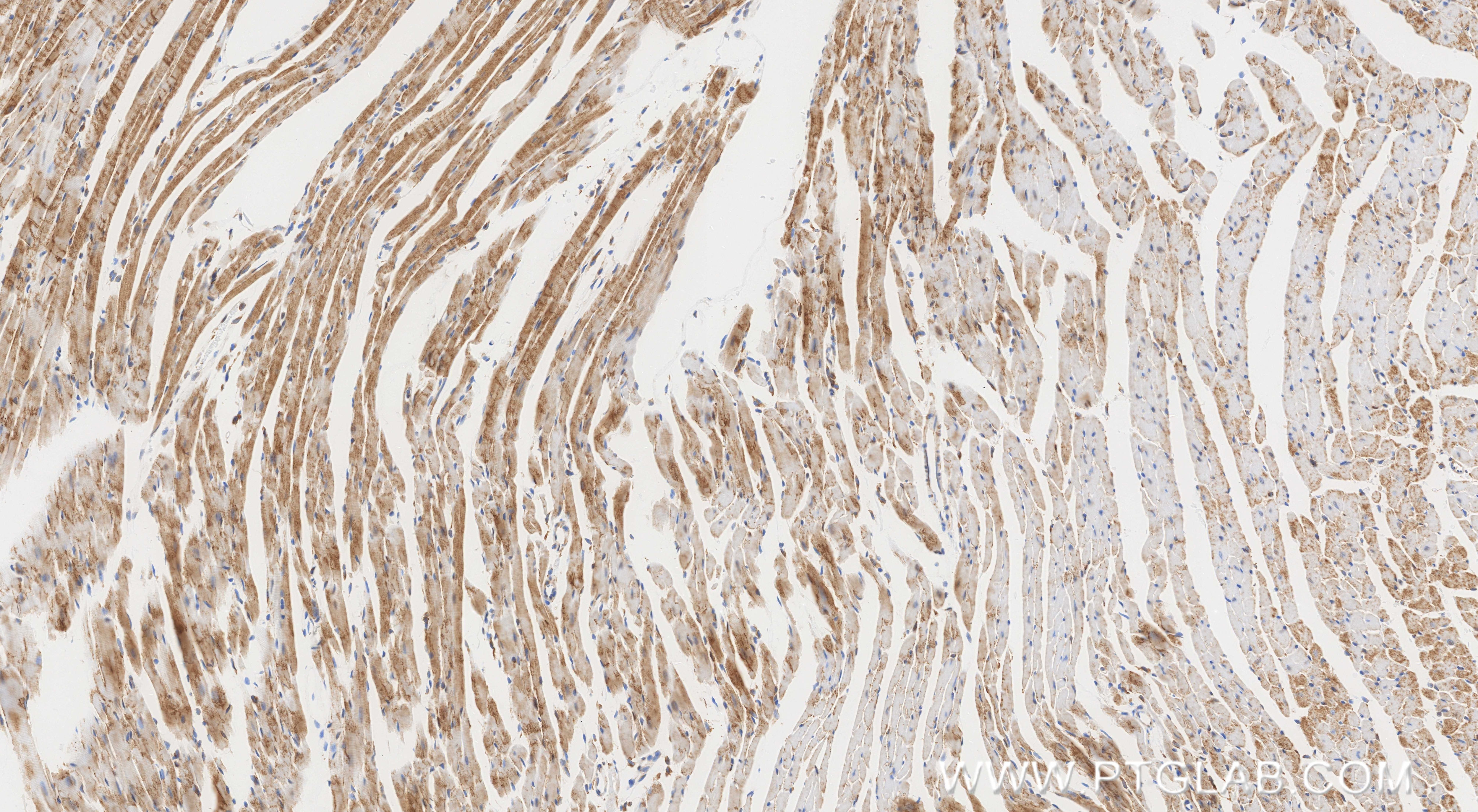 Immunohistochemistry (IHC) staining of mouse heart tissue using GPNMB Recombinant monoclonal antibody (86874-1-RR)