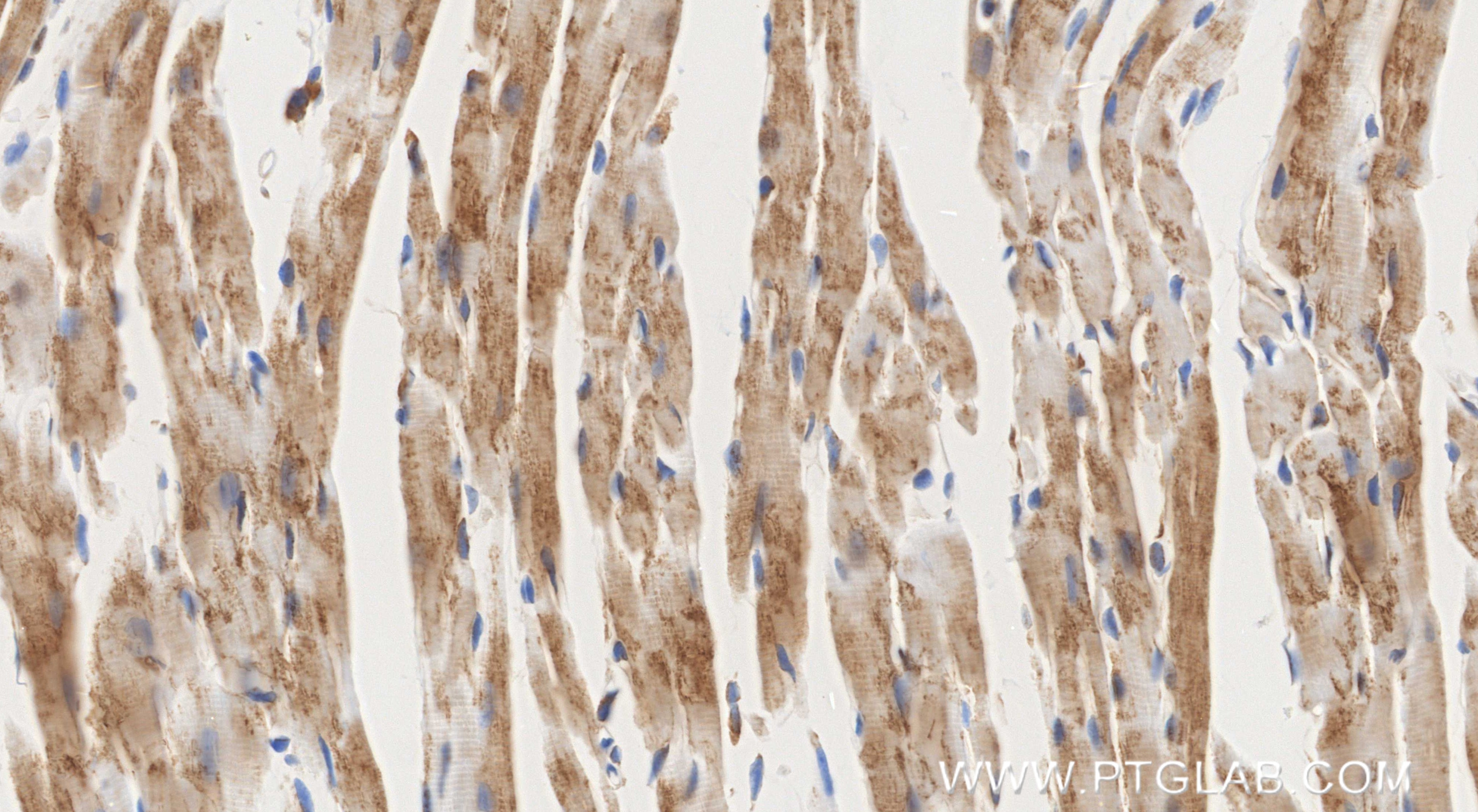 Immunohistochemistry (IHC) staining of mouse heart tissue using GPNMB Recombinant monoclonal antibody (86874-1-RR)