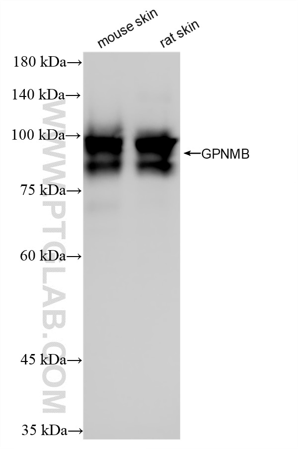 Western Blot (WB) analysis of various lysates using Gpnmb Recombinant monoclonal antibody (86874-1-RR)