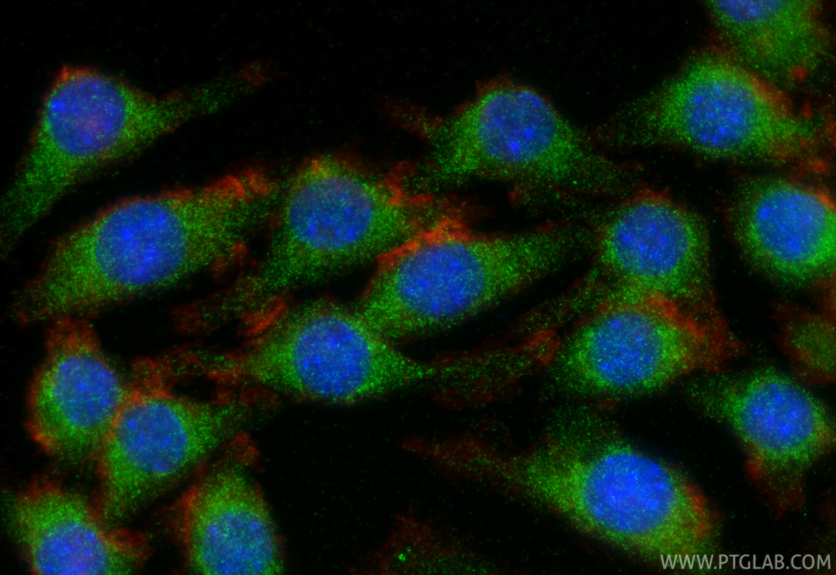 Immunofluorescence (IF) / fluorescent staining of J774A.1 cells using Progranulin/PGRN Polyclonal antibody (29491-1-AP)