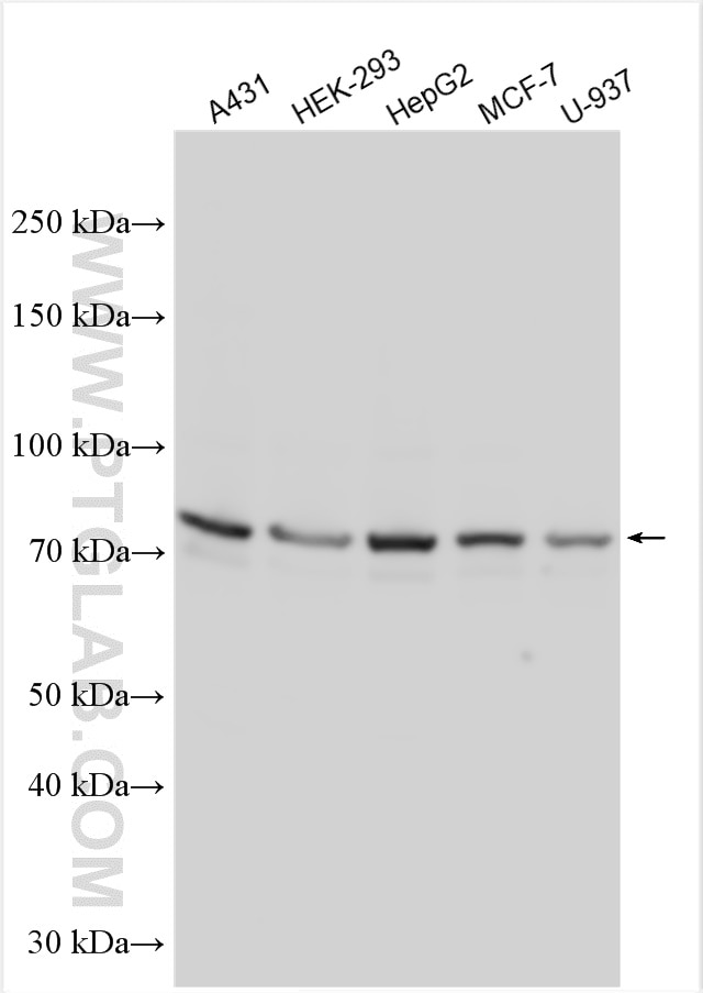 Western Blot (WB) analysis of various lysates using Granulin Polyclonal antibody (29491-1-AP)