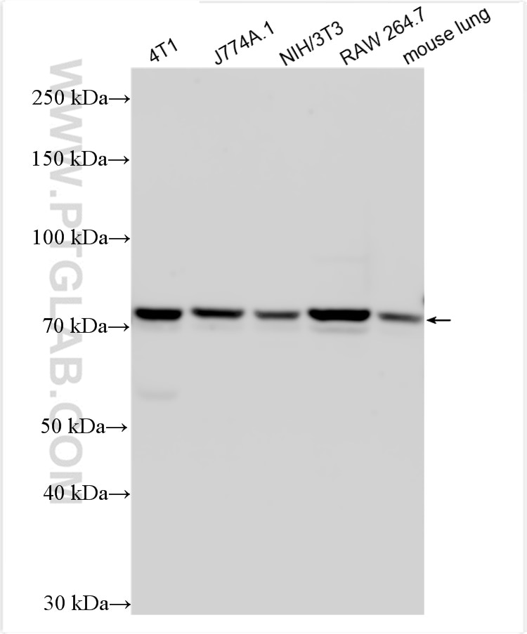 Western Blot (WB) analysis of various lysates using Granulin Polyclonal antibody (29491-1-AP)