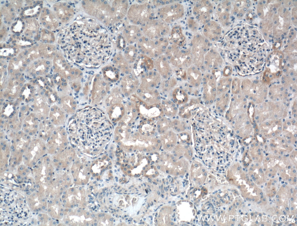 Immunohistochemistry (IHC) staining of human kidney tissue using Biotin-conjugated Granulin Polyclonal antibody (Biotin-18410)