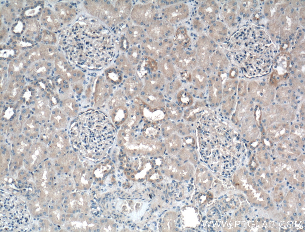 IHC staining of human kidney using Biotin-18410