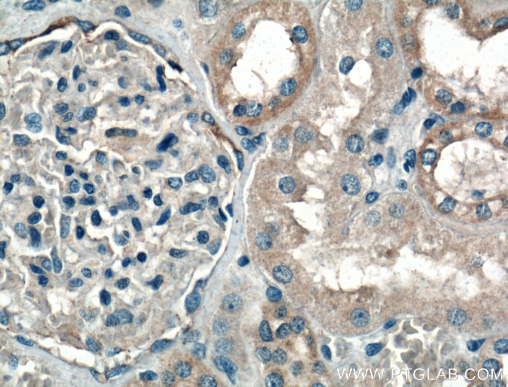 Immunohistochemistry (IHC) staining of human kidney tissue using Biotin-conjugated Granulin Polyclonal antibody (Biotin-18410)