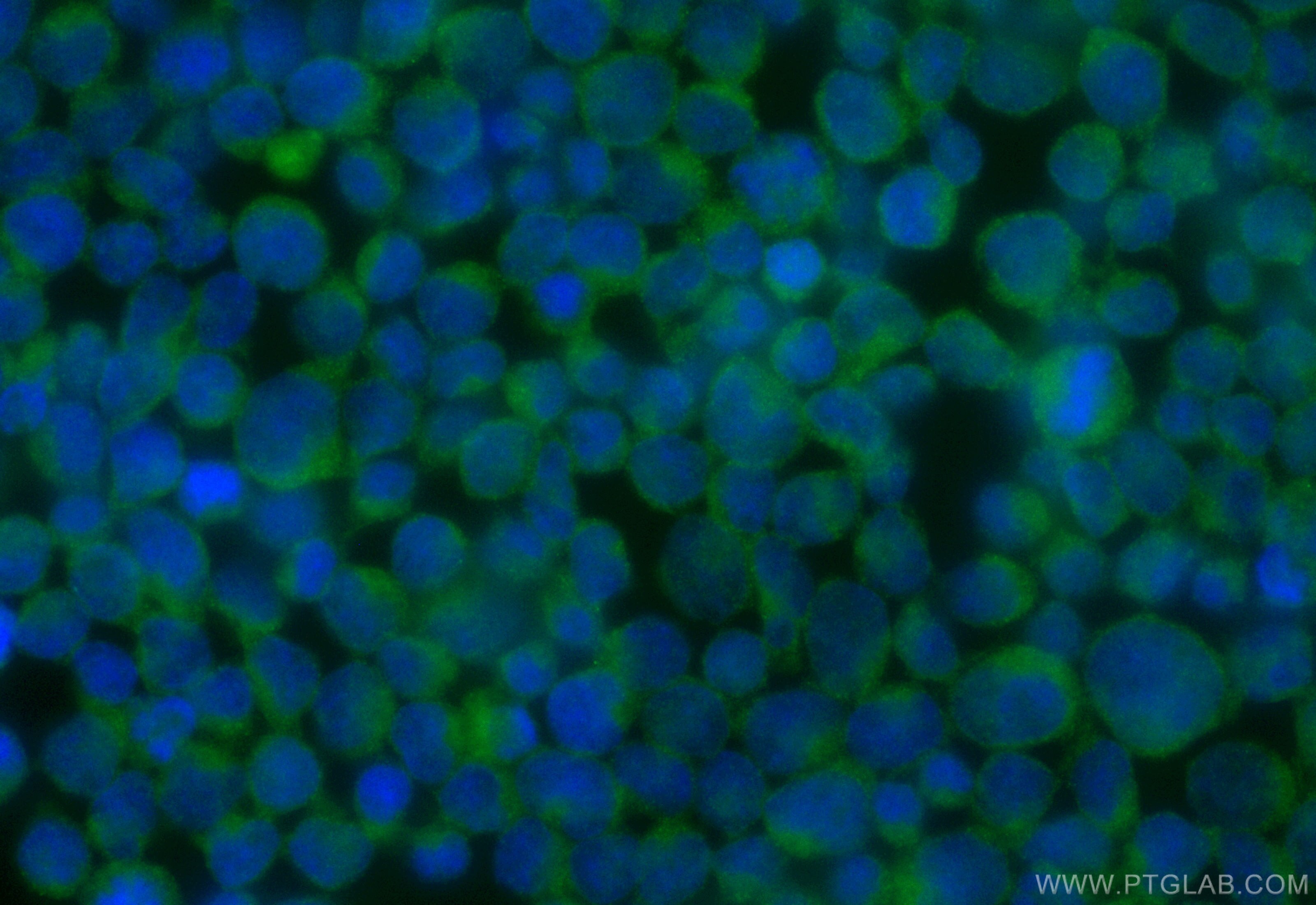 Immunofluorescence (IF) / fluorescent staining of Jurkat cells using CoraLite® Plus 488-conjugated Granzyme A Recombina (CL488-84583-3)