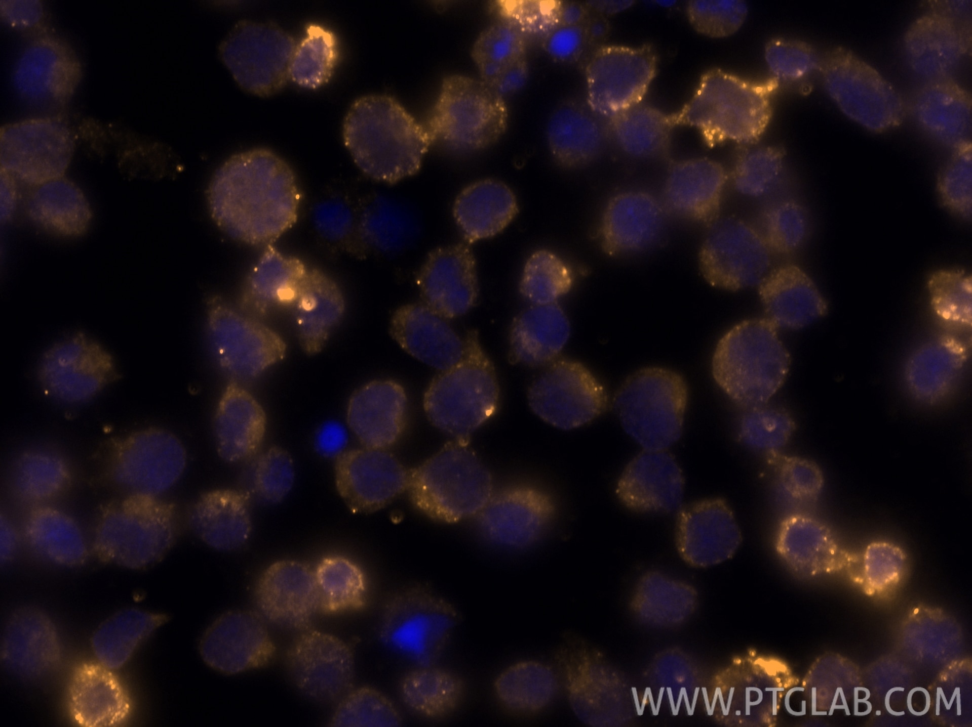 Immunofluorescent analysis of (4% PFA) fixed Jurkat cells using CoraLite® Plus 555 Granzyme B antibody (CL555-13588) at dilution of 1:200. Immunofluorescence (IF) / fluorescent staining of Jurkat cells using CoraLite® Plus 555-conjugated Granzyme B Polyclona (CL555-13588)