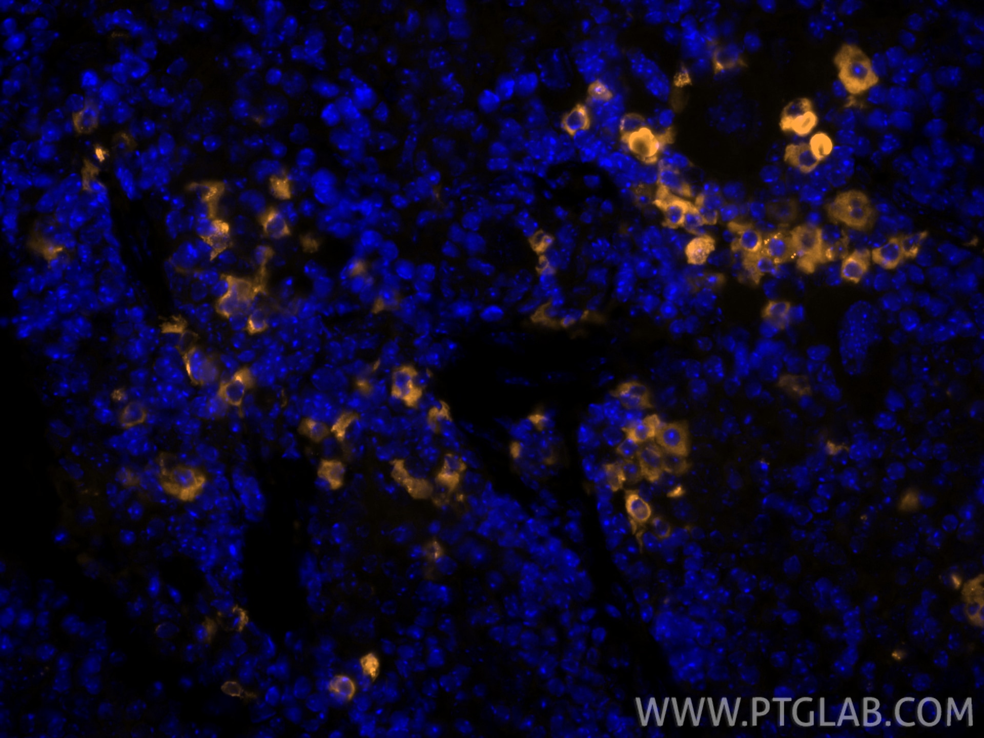 IF Staining of mouse spleen using CL555-13588 Immunofluorescence (IF) / fluorescent staining of mouse spleen tissue using CoraLite® Plus 555-conjugated Granzyme B Polyclona (CL555-13588)
