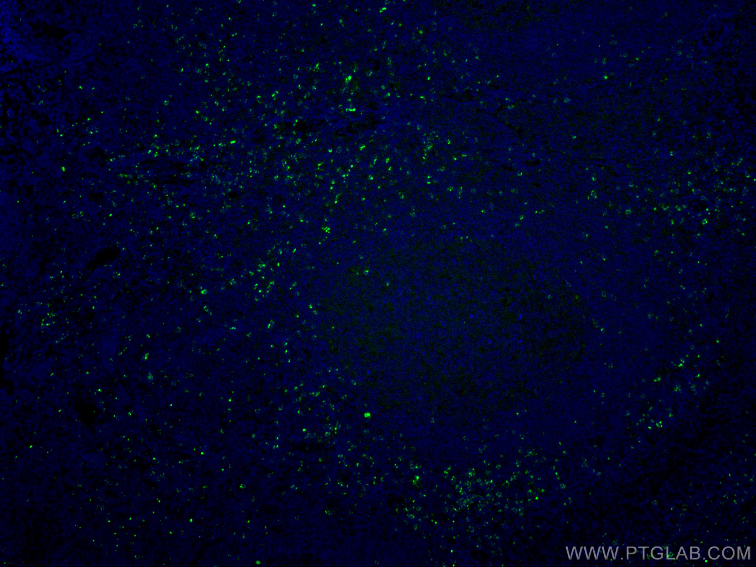 Immunofluorescence (IF) / fluorescent staining of human tonsillitis tissue using CoraLite® Plus 488-conjugated Granzyme K Monoclona (CL488-67272)