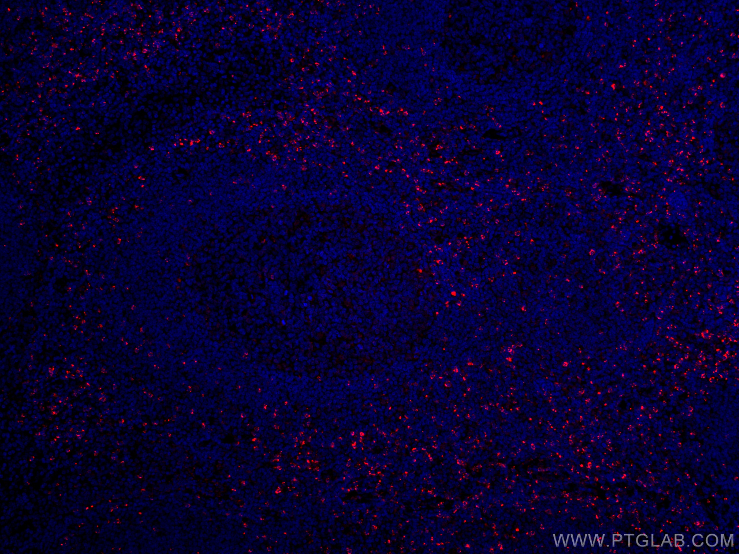 Immunofluorescence (IF) / fluorescent staining of human tonsillitis tissue using CoraLite®594-conjugated Granzyme K Monoclonal anti (CL594-67272)