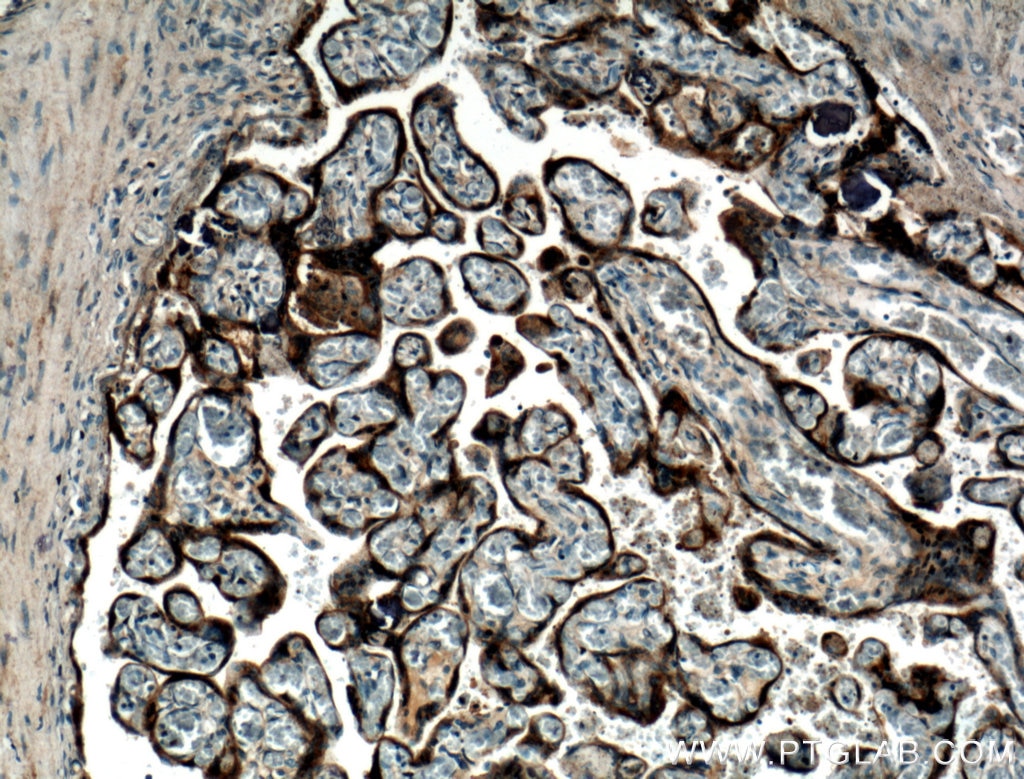 Immunohistochemistry (IHC) staining of human placenta tissue using GH1 Polyclonal antibody (27079-1-AP)