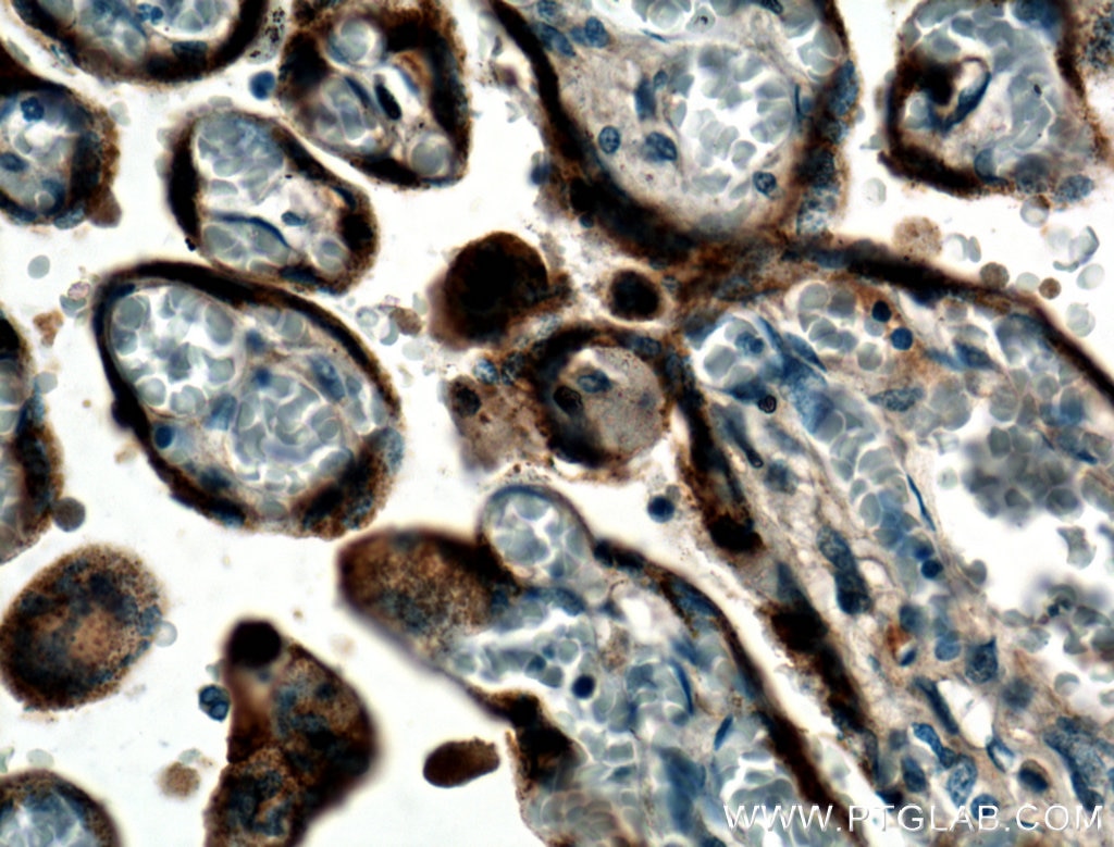 Immunohistochemistry (IHC) staining of human placenta tissue using GH1 Polyclonal antibody (27079-1-AP)