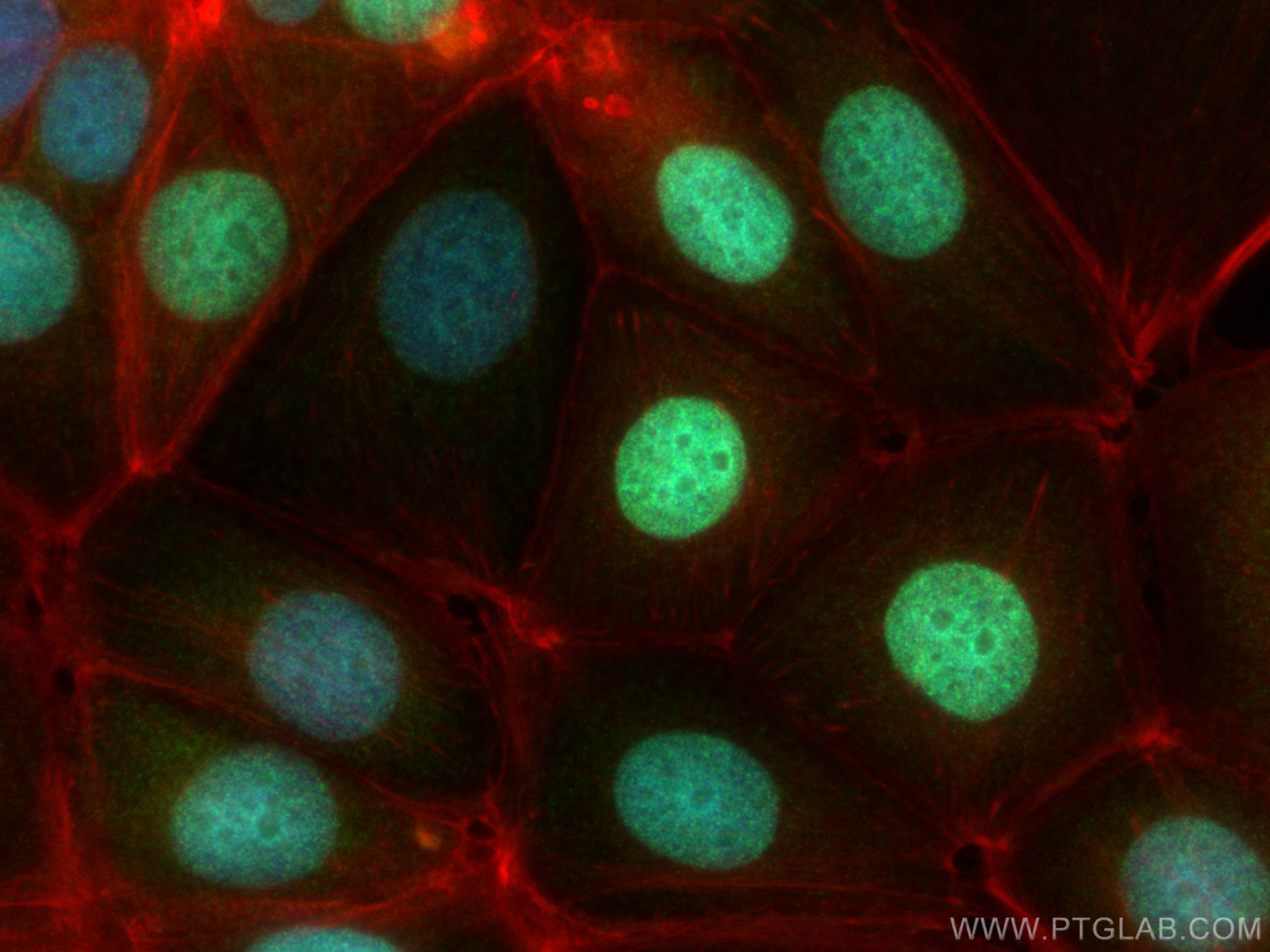 Immunofluorescence (IF) / fluorescent staining of MCF-7 cells using Histone H1.0 Polyclonal antibody (17510-1-AP)