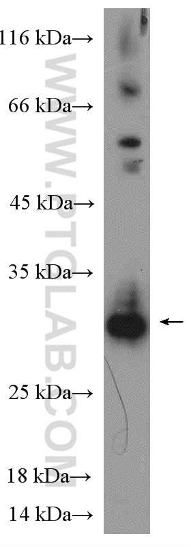 Western Blot (WB) analysis of mouse spleen tissue using Histone H1.0 Polyclonal antibody (17510-1-AP)