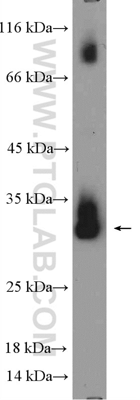 Western Blot (WB) analysis of rat spleen tissue using Histone H1.0 Polyclonal antibody (17510-1-AP)