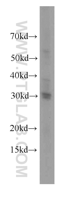 Western Blot (WB) analysis of HeLa cells using Histone H1.0 Polyclonal antibody (17510-1-AP)