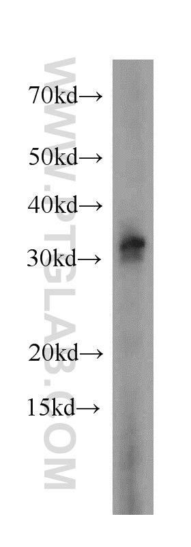 Western Blot (WB) analysis of A431 cells using Histone H1.0 Polyclonal antibody (17510-1-AP)