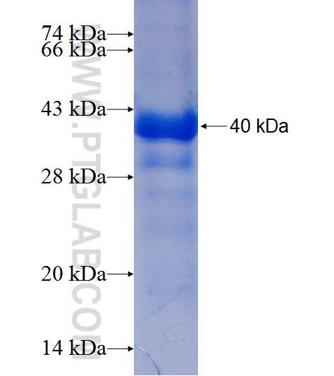 H2AFJ fusion protein Ag7194 SDS-PAGE