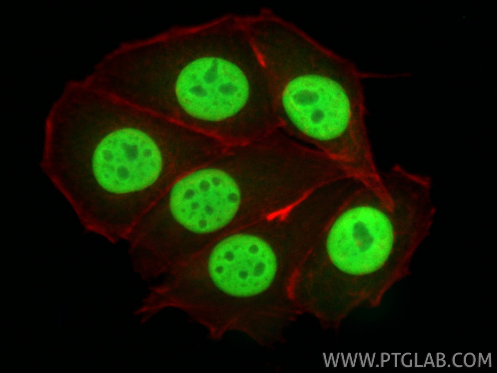 Immunofluorescence (IF) / fluorescent staining of MCF-7 cells using Histone H2A.X Polyclonal antibody (10856-1-AP)