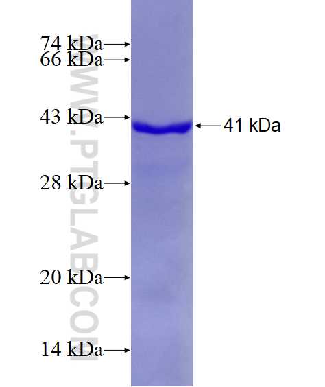 Histone H2A.X fusion protein Ag1305 SDS-PAGE