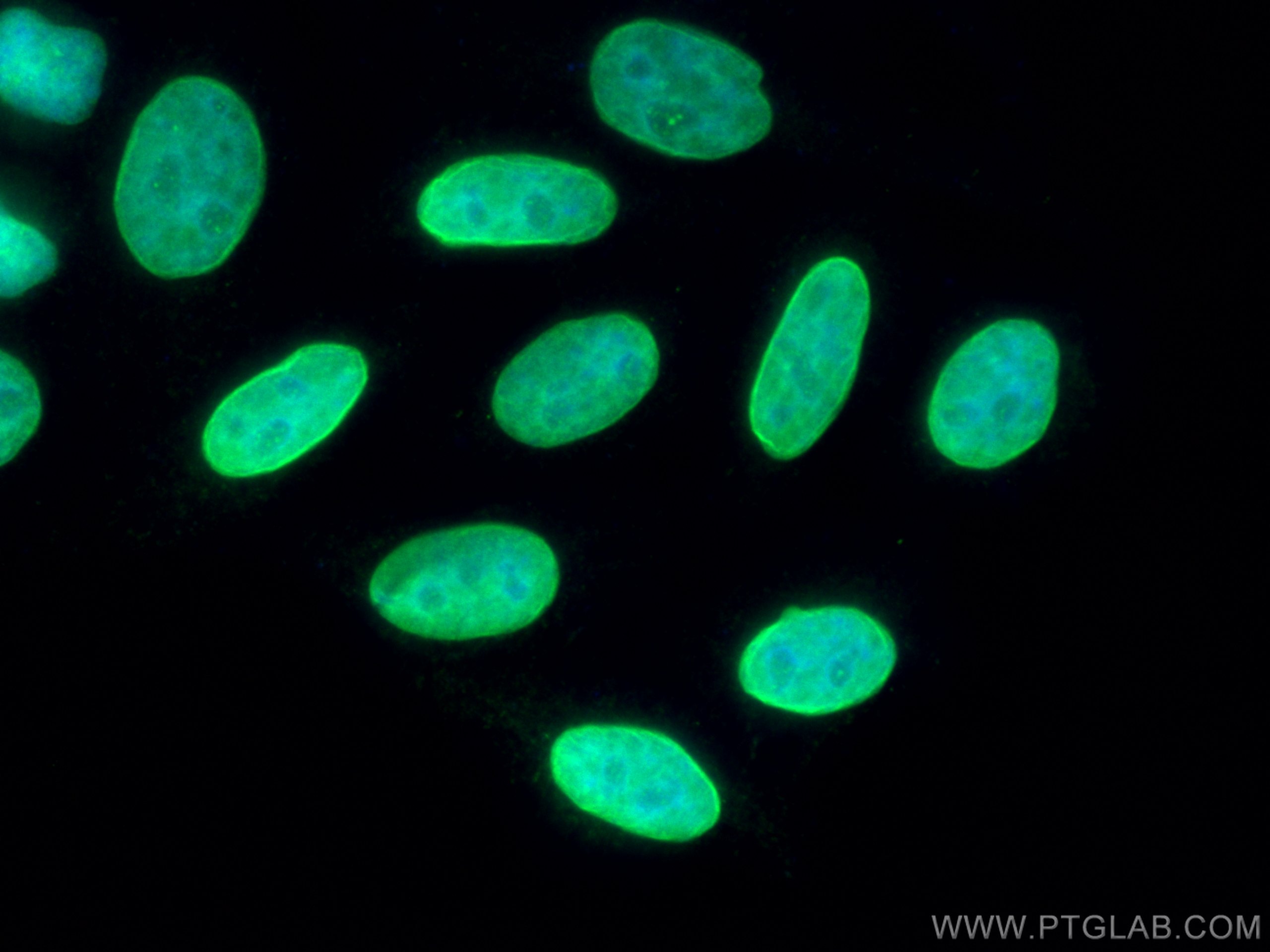 Immunofluorescence (IF) / fluorescent staining of HepG2 cells using H2AFY Polyclonal antibody (26875-1-AP)
