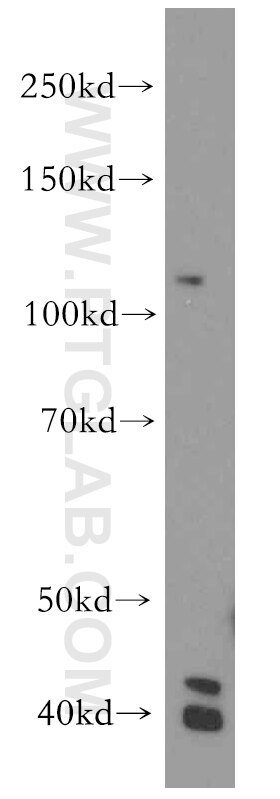 Western Blot (WB) analysis of mouse kidney tissue using H2AFY2 Polyclonal antibody (17030-1-AP)