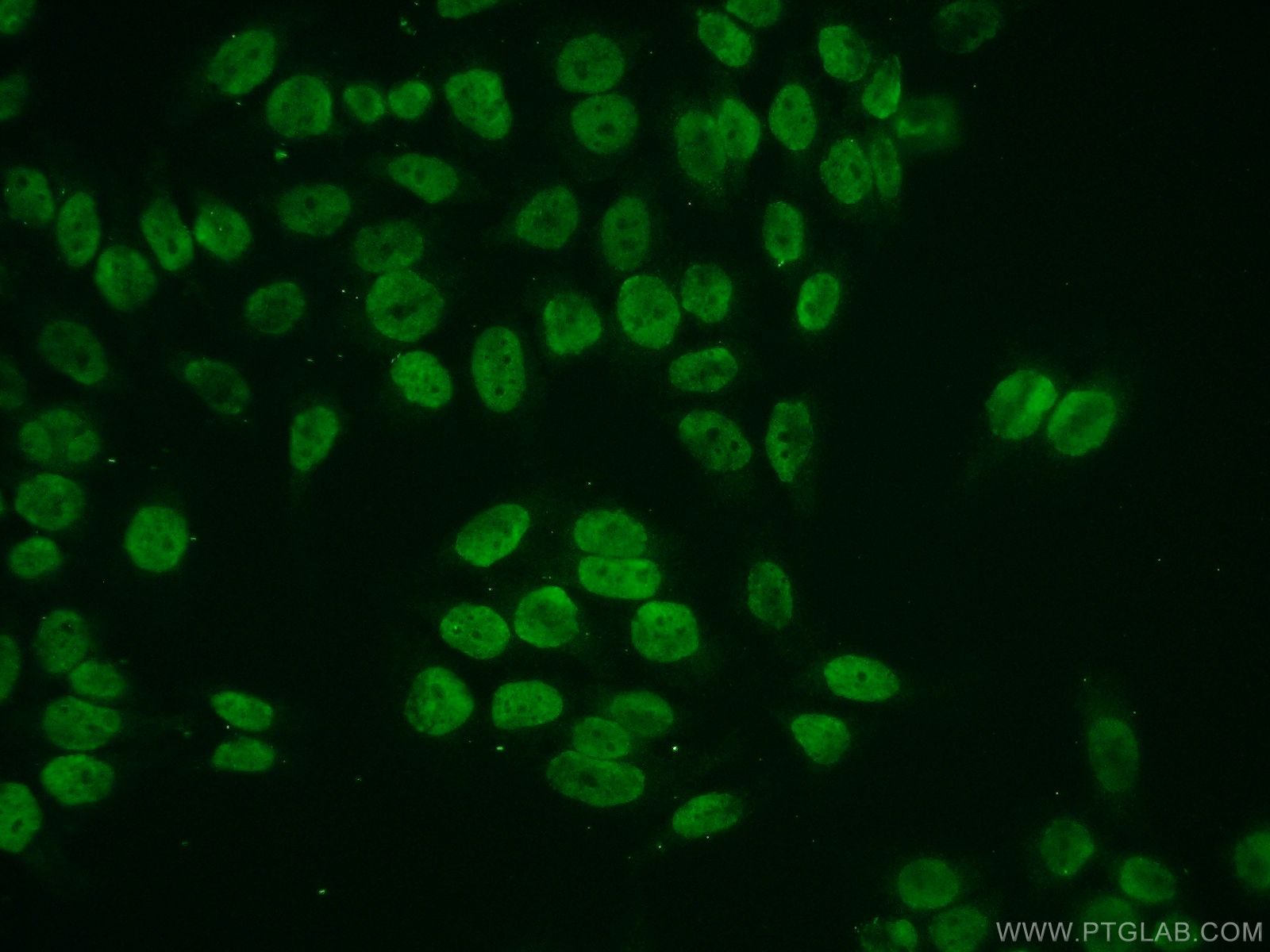Immunofluorescence (IF) / fluorescent staining of HeLa cells using Histone H2A.z Polyclonal antibody (16441-1-AP)