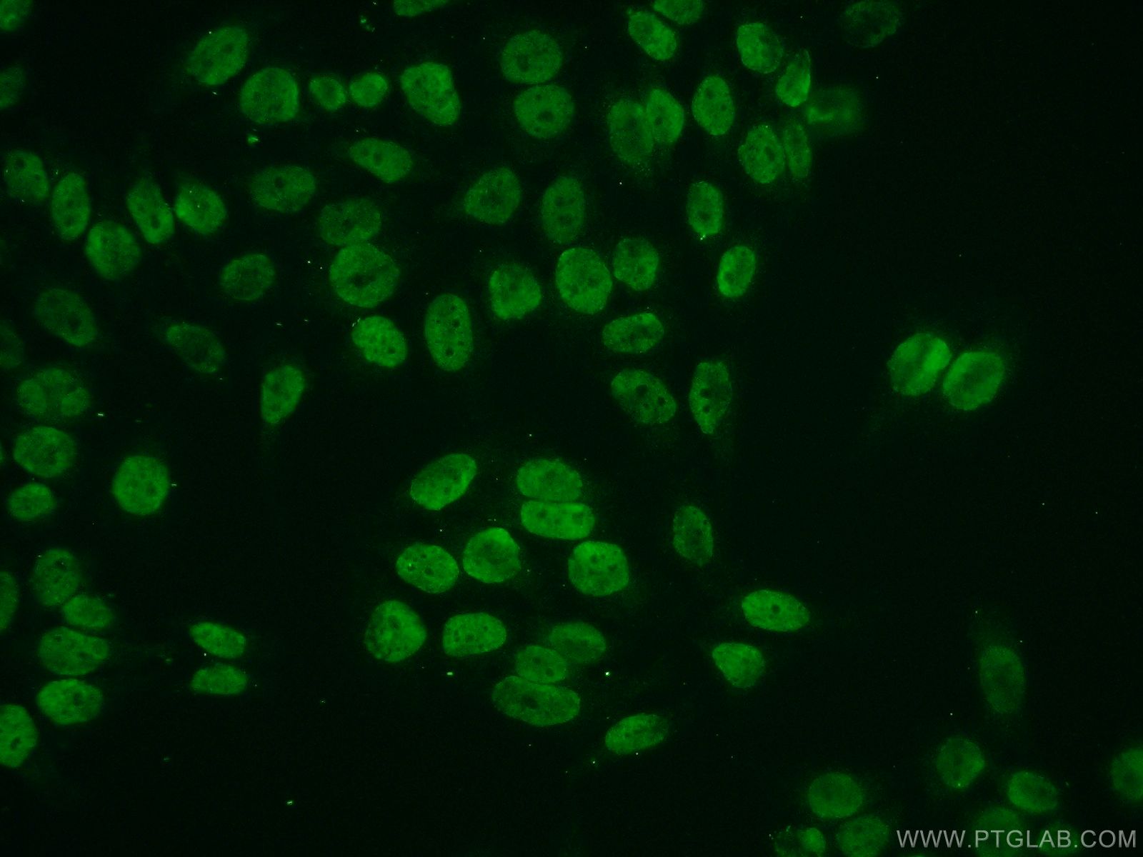 IF Staining of HeLa using 16441-1-AP