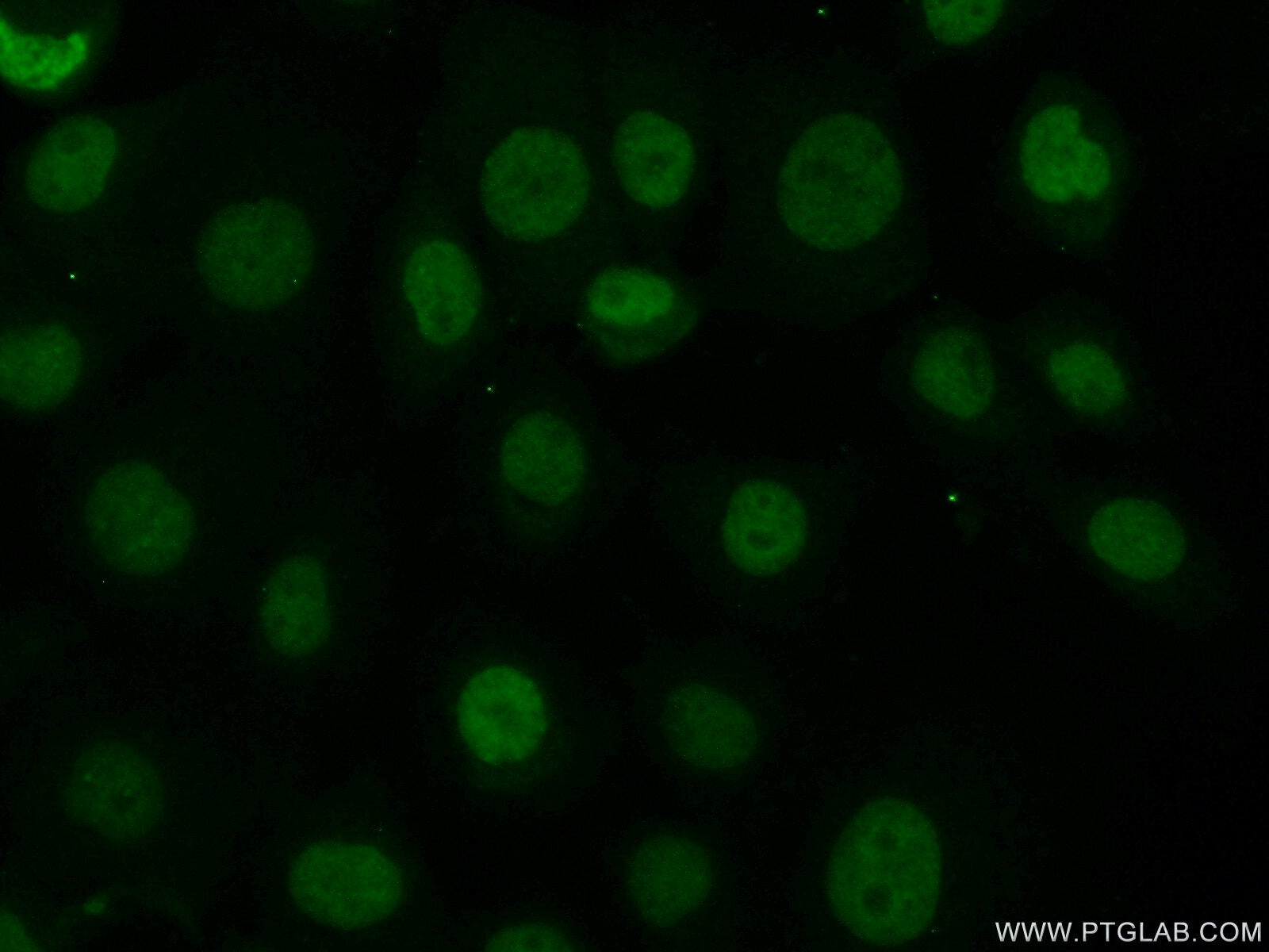 Immunofluorescence (IF) / fluorescent staining of A431 cells using Histone H3.3 Polyclonal antibody (13754-1-AP)