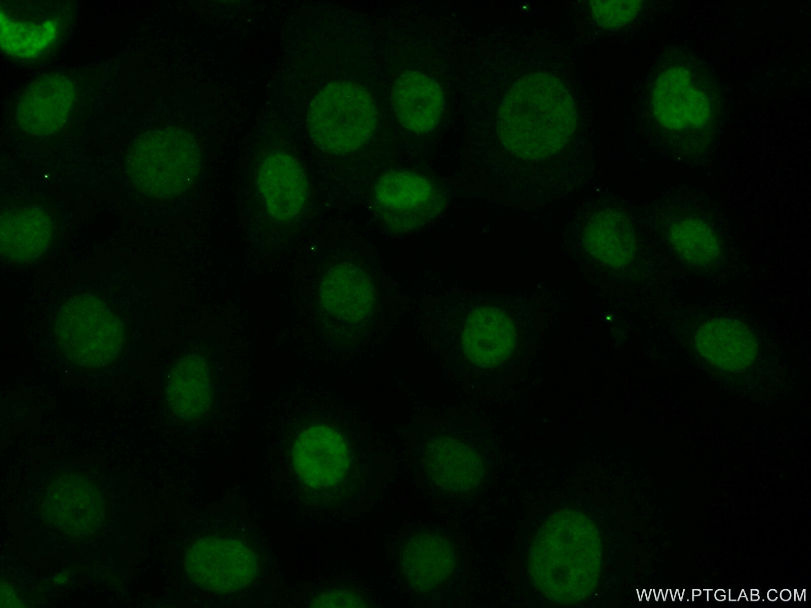 IF Staining of A431 using 13754-1-AP