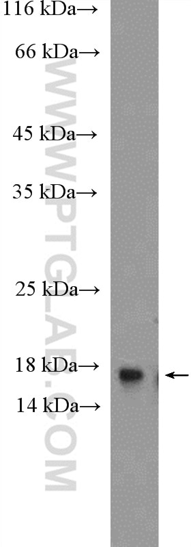 H3F3B Polyclonal antibody