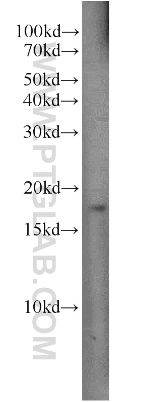 WB analysis of HeLa using 10265-1-AP