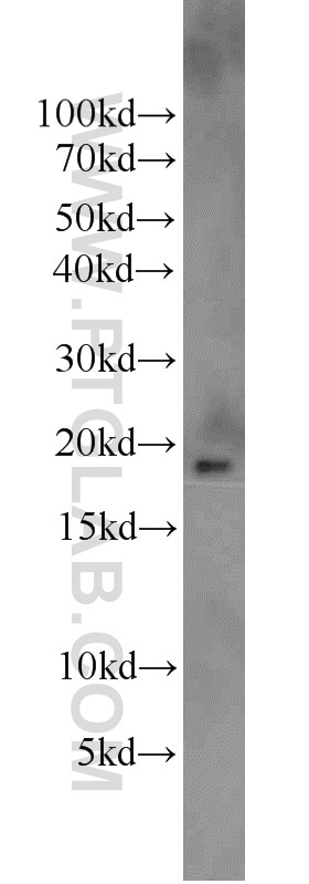 H3F3B Polyclonal antibody