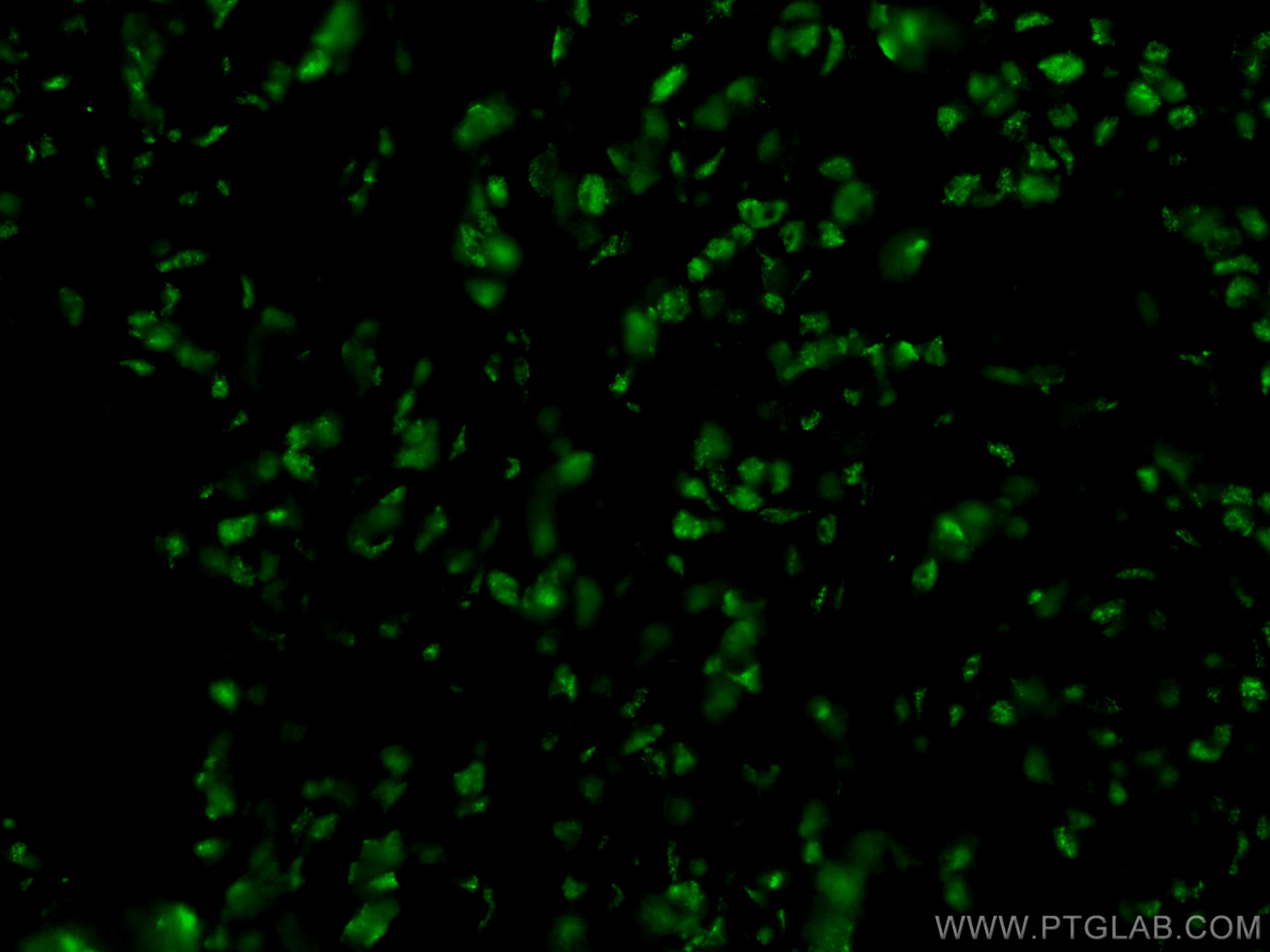 Immunofluorescence (IF) / fluorescent staining of human breast cancer tissue using Phospho-Histone H3 (Ser10) Monoclonal antibody (66863-1-Ig)
